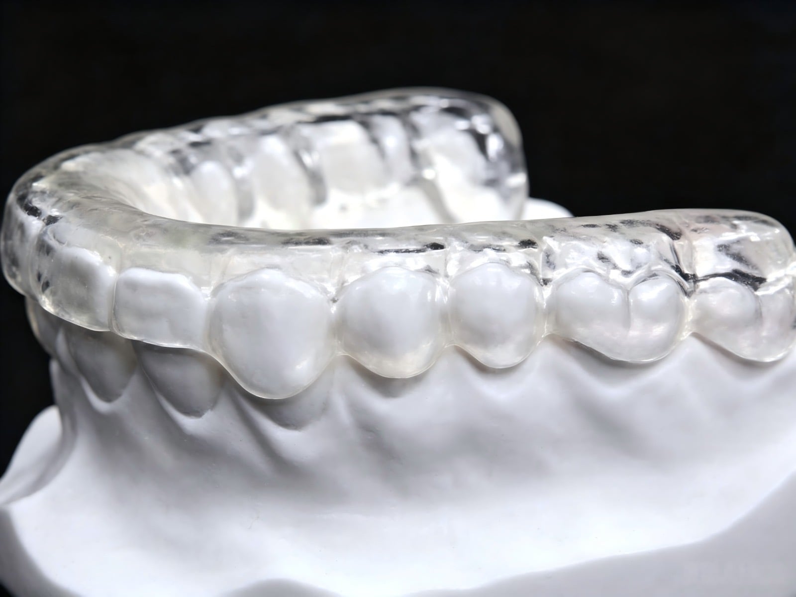 Clear Essix retainer on a dental model